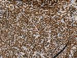 H2A.Zac pan-acetyl (K4,K7,K11,K13) Antibody in Immunohistochemistry (Paraffin) (IHC (P))