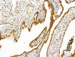 H2A.Zac pan-acetyl (K4,K7,K11,K13) Antibody in Immunohistochemistry (Paraffin) (IHC (P))