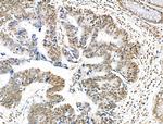 H2BK5ac Antibody in Immunohistochemistry (Paraffin) (IHC (P))