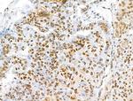 H2BK5ac Antibody in Immunohistochemistry (Paraffin) (IHC (P))