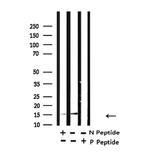 H2BK5ac Antibody in Western Blot (WB)