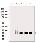 H2BK20ac Antibody in Western Blot (WB)