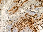 H2BK20ac Antibody in Immunohistochemistry (Paraffin) (IHC (P))