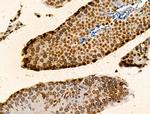 H2BK20ac Antibody in Immunohistochemistry (Paraffin) (IHC (P))