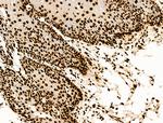 H2BK20ac Antibody in Immunohistochemistry (Paraffin) (IHC (P))