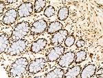 H2BK20ac Antibody in Immunohistochemistry (Paraffin) (IHC (P))