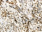 H2BK20ac Antibody in Immunohistochemistry (Paraffin) (IHC (P))