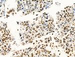 H2BK20ac Antibody in Immunohistochemistry (Paraffin) (IHC (P))