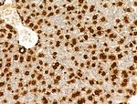 H2BK20ac Antibody in Immunohistochemistry (Paraffin) (IHC (P))