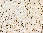 Histone H3ac (pan-acetyl) Antibody in Immunohistochemistry (Paraffin) (IHC (P))