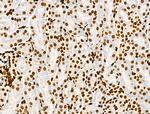 Histone H3ac (pan-acetyl) Antibody in Immunohistochemistry (Paraffin) (IHC (P))