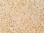 Histone H3ac (pan-acetyl) Antibody in Immunohistochemistry (Paraffin) (IHC (P))