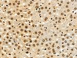 Histone H3ac (pan-acetyl) Antibody in Immunohistochemistry (Paraffin) (IHC (P))