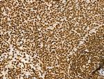 Histone H3ac (pan-acetyl) Antibody in Immunohistochemistry (Paraffin) (IHC (P))