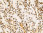 Histone H3ac (pan-acetyl) Antibody in Immunohistochemistry (Paraffin) (IHC (P))