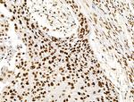 Histone H3ac (pan-acetyl) Antibody in Immunohistochemistry (Paraffin) (IHC (P))