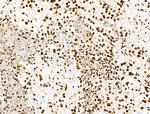 Histone H3ac (pan-acetyl) Antibody in Immunohistochemistry (Paraffin) (IHC (P))