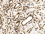 Histone H3ac (pan-acetyl) Antibody in Immunohistochemistry (Paraffin) (IHC (P))