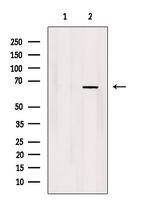 Acetyl-NFkB p65 (Lys314, Lys315) Antibody in Western Blot (WB)