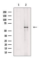 Calcium Channel beta-4 Antibody in Western Blot (WB)