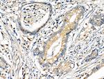 CD2AP Antibody in Immunohistochemistry (Paraffin) (IHC (P))