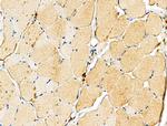 CD2AP Antibody in Immunohistochemistry (Paraffin) (IHC (P))