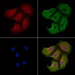 CD154 (CD40 Ligand) Antibody in Immunocytochemistry (ICC/IF)