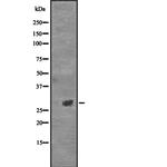 CD154 (CD40 Ligand) Antibody in Western Blot (WB)