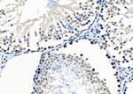 E2F7 Antibody in Immunohistochemistry (Paraffin) (IHC (P))