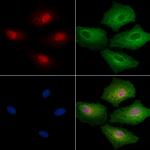 EHMT1 Antibody in Immunocytochemistry (ICC/IF)