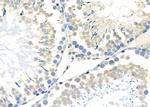 FN3K Antibody in Immunohistochemistry (Paraffin) (IHC (P))