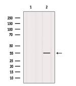 FN3K Antibody in Western Blot (WB)