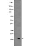 IL-15 Antibody in Western Blot (WB)