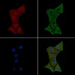 ITGA2 Antibody in Immunocytochemistry (ICC/IF)