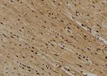 ITGA2 Antibody in Immunohistochemistry (Paraffin) (IHC (P))