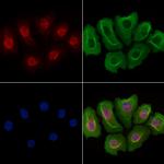 JMJD1B Antibody in Immunocytochemistry (ICC/IF)