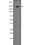 JMJD1B Antibody in Western Blot (WB)