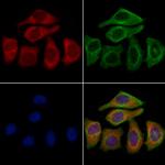 KCNN1 Antibody in Immunocytochemistry (ICC/IF)