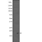 PDCD5 Antibody in Western Blot (WB)