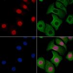 ESRP2 Antibody in Immunocytochemistry (ICC/IF)