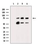 ST2 Antibody in Western Blot (WB)