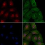 TAF7 Antibody in Immunocytochemistry (ICC/IF)