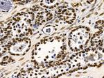 TAF7 Antibody in Immunohistochemistry (Paraffin) (IHC (P))