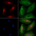 TBR1 Antibody in Immunocytochemistry (ICC/IF)