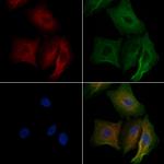 TNNT3 Antibody in Immunocytochemistry (ICC/IF)