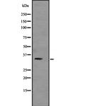 TNNT3 Antibody in Western Blot (WB)