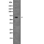 UNC5C Antibody in Western Blot (WB)