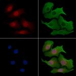 KAISO Antibody in Immunocytochemistry (ICC/IF)