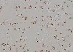 ALOX5 Antibody in Immunohistochemistry (Paraffin) (IHC (P))