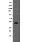 RPSA Antibody in Western Blot (WB)